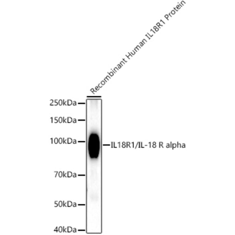 Western Blot - Anti-IL-18R1 Antibody [ARC52216] (A305763) - Antibodies.com