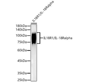 Western Blot - Anti-IL-18R1 Antibody [ARC52215] (A305764) - Antibodies.com