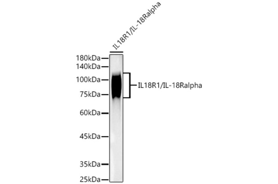 Western Blot - Anti-IL-18R1 Antibody [ARC52215] (A305764) - Antibodies.com