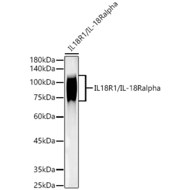 Western Blot - Anti-IL-18R1 Antibody [ARC52215] (A305764) - Antibodies.com