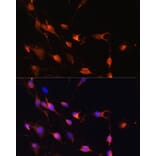 Immunofluorescence - Anti-Rab11A Antibody (A305765) - Antibodies.com