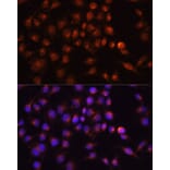 Immunofluorescence - Anti-Rab11A Antibody (A305765) - Antibodies.com