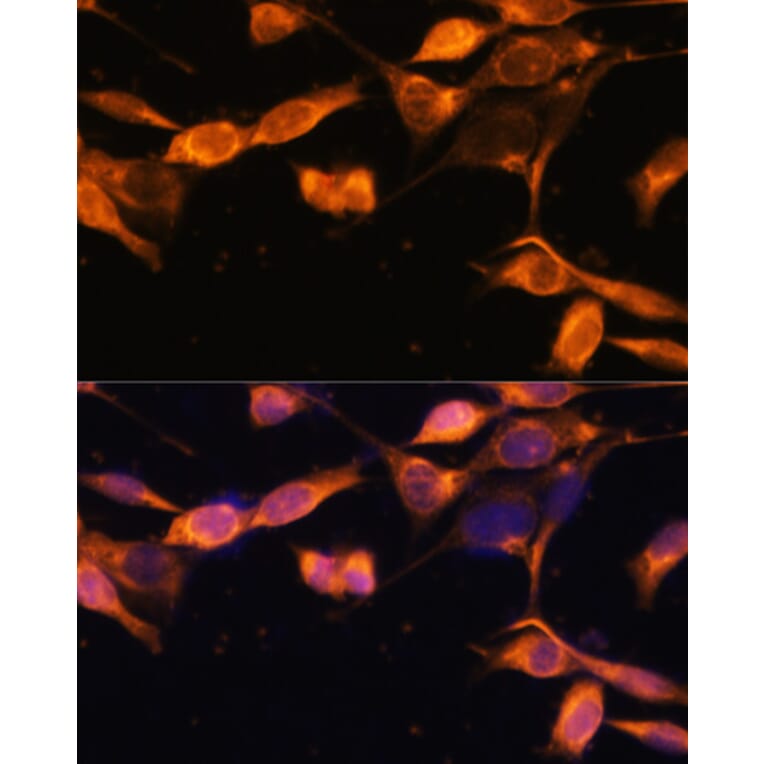 Immunofluorescence - Anti-Rab11A Antibody (A305765) - Antibodies.com