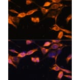 Immunofluorescence - Anti-Rab11A Antibody (A305765) - Antibodies.com