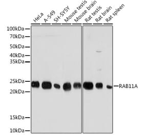 Western Blot - Anti-Rab11A Antibody [ARC0767] (A305766) - Antibodies.com