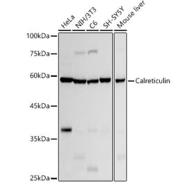 Western Blot - Anti-Calreticulin Antibody [ARC51269] (A305767) - Antibodies.com