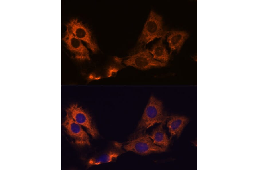 Immunofluorescence - Anti-SMAP1 Antibody (A305769) - Antibodies.com