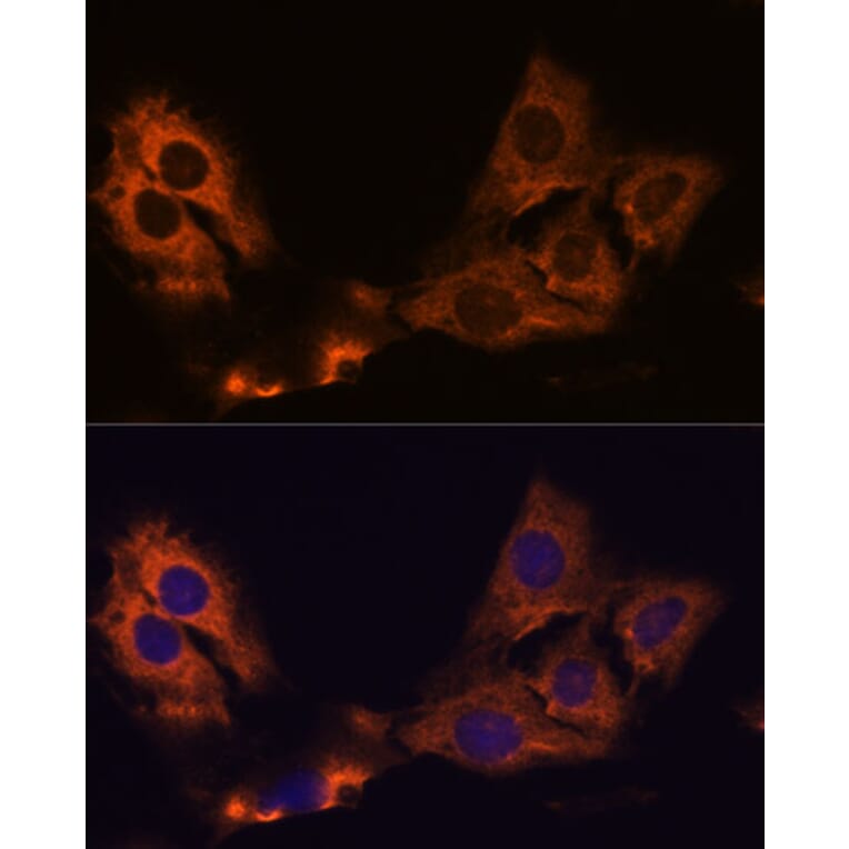 Immunofluorescence - Anti-SMAP1 Antibody (A305769) - Antibodies.com