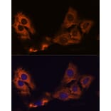Immunofluorescence - Anti-SMAP1 Antibody (A305769) - Antibodies.com