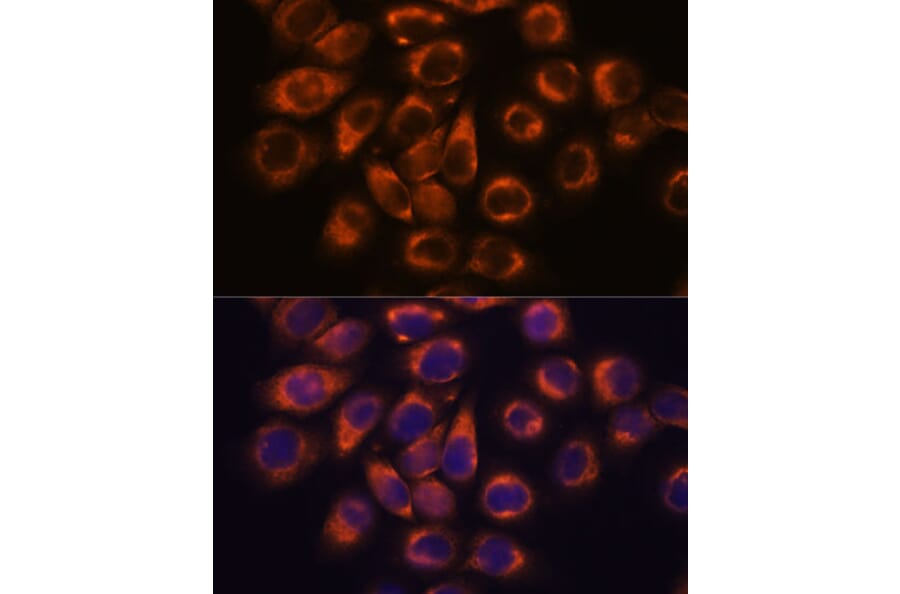 Immunofluorescence - Anti-SMAP1 Antibody (A305769) - Antibodies.com