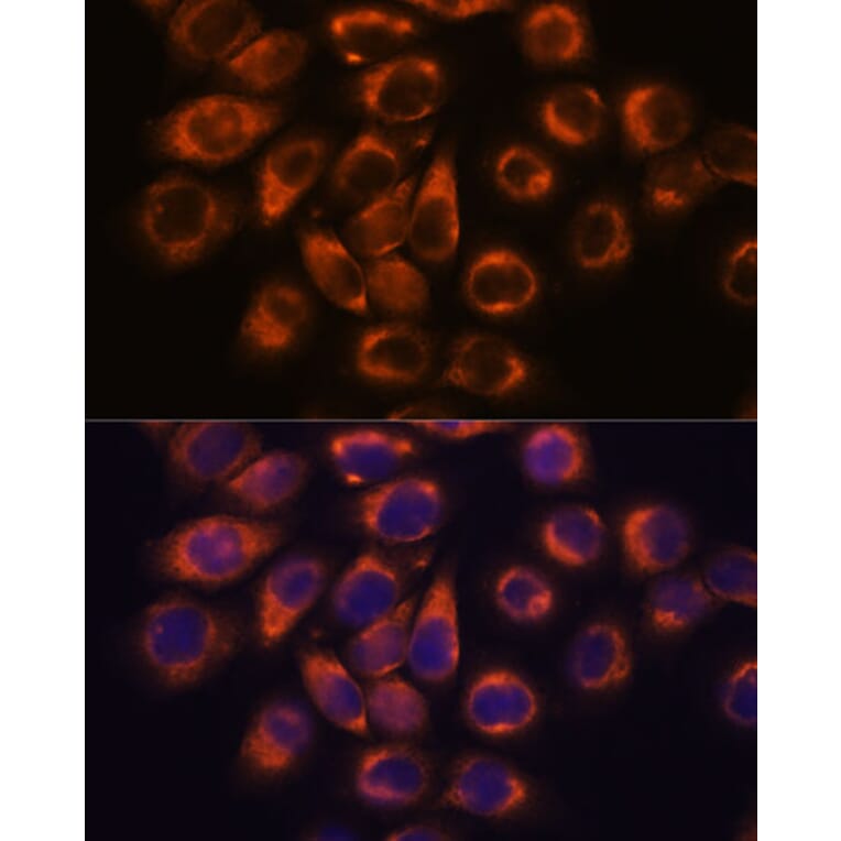 Immunofluorescence - Anti-SMAP1 Antibody (A305769) - Antibodies.com