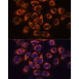 Immunofluorescence - Anti-SMAP1 Antibody (A305769) - Antibodies.com