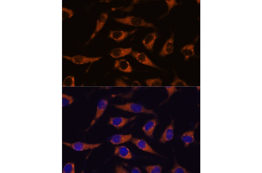 Immunofluorescence - Anti-SMAP1 Antibody (A305769) - Antibodies.com