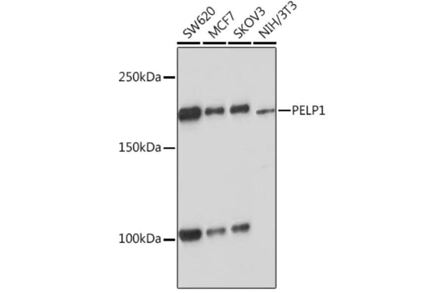 Western Blot - Anti-PELP1 Antibody [ARC1387] (A305770) - Antibodies.com