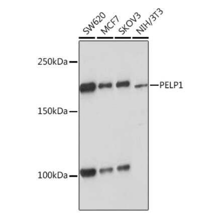 Western Blot - Anti-PELP1 Antibody [ARC1387] (A305770) - Antibodies.com