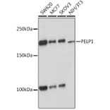 Western Blot - Anti-PELP1 Antibody [ARC1387] (A305770) - Antibodies.com