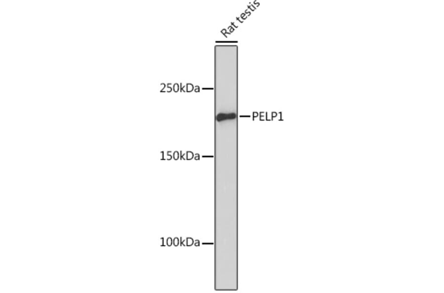 Western Blot - Anti-PELP1 Antibody [ARC1387] (A305770) - Antibodies.com