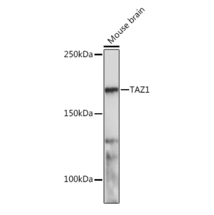 Western Blot - Anti-TOPAZ1 Antibody (A305771) - Antibodies.com