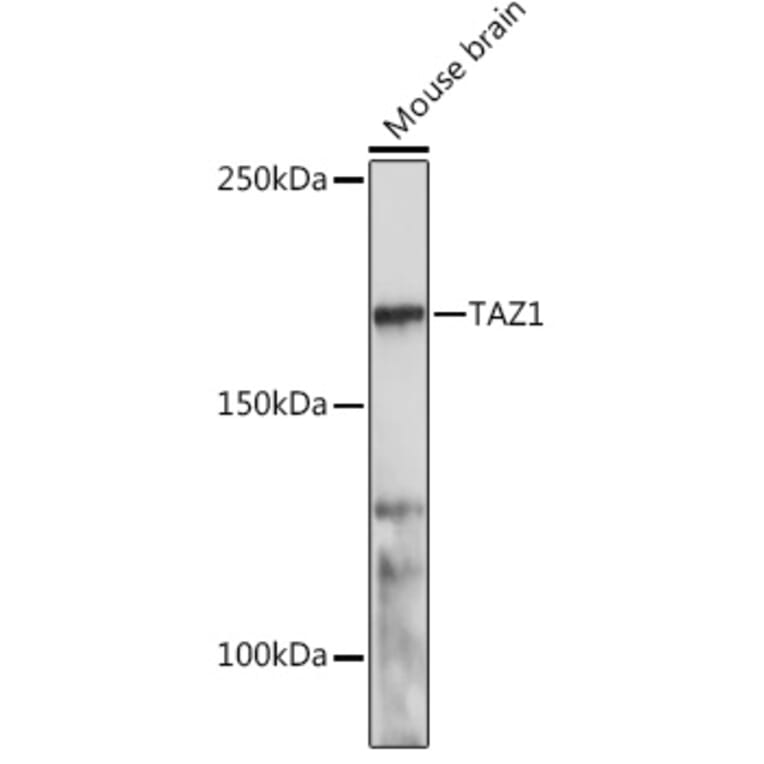 Western Blot - Anti-TOPAZ1 Antibody (A305771) - Antibodies.com
