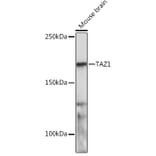 Western Blot - Anti-TOPAZ1 Antibody (A305771) - Antibodies.com
