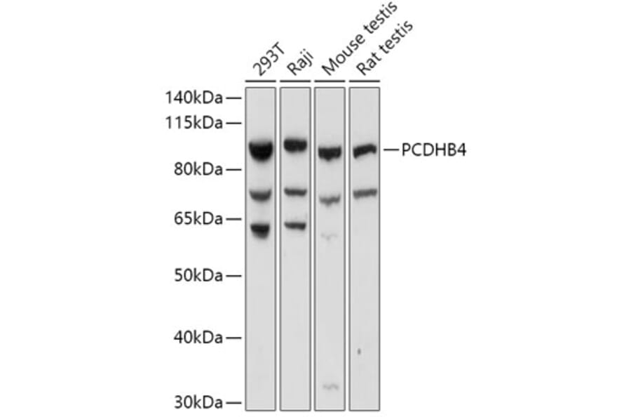 Western Blot - Anti-PCDHB4 Antibody (A305773) - Antibodies.com