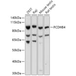 Western Blot - Anti-PCDHB4 Antibody (A305773) - Antibodies.com