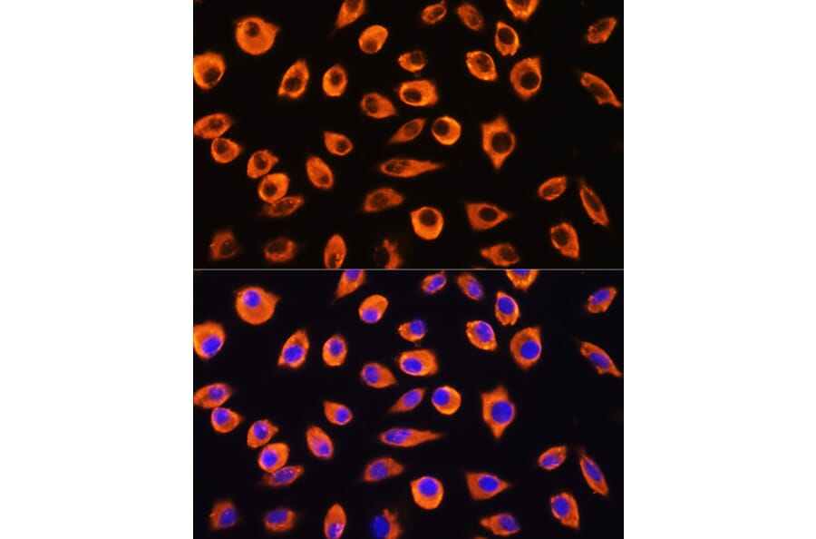 Immunofluorescence - Anti-PCDHB4 Antibody (A305773) - Antibodies.com