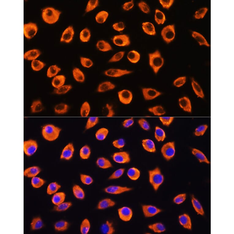 Immunofluorescence - Anti-PCDHB4 Antibody (A305773) - Antibodies.com