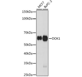Western Blot - Anti-DOK1 Antibody [ARC2410] (A305774) - Antibodies.com