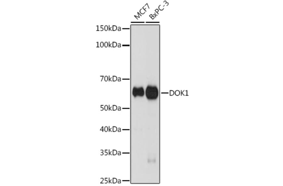 Western Blot - Anti-DOK1 Antibody [ARC2410] (A305774) - Antibodies.com
