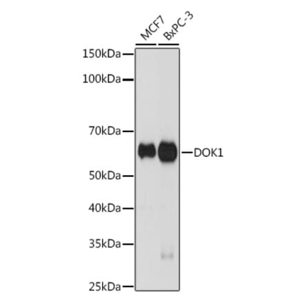 Western Blot - Anti-DOK1 Antibody [ARC2410] (A305774) - Antibodies.com