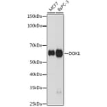 Western Blot - Anti-DOK1 Antibody [ARC2410] (A305774) - Antibodies.com