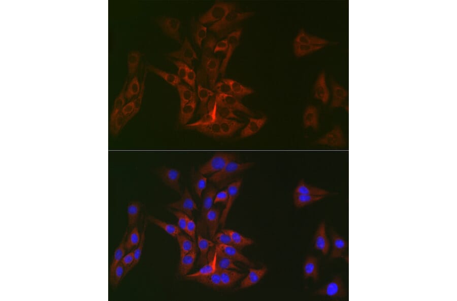 Immunofluorescence - Anti-DOK1 Antibody [ARC2410] (A305774) - Antibodies.com