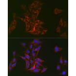 Immunofluorescence - Anti-DOK1 Antibody [ARC2410] (A305774) - Antibodies.com