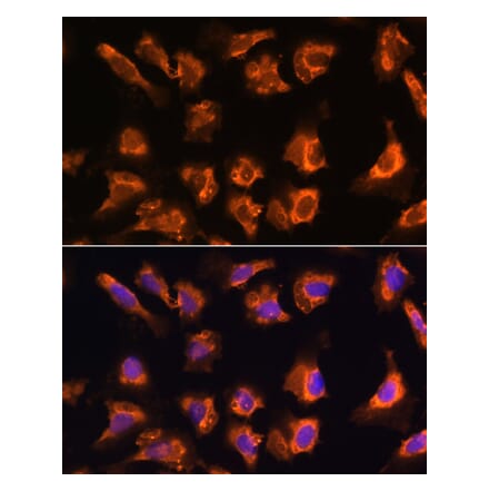 Immunofluorescence - Anti-OBSCN Antibody (A305775) - Antibodies.com