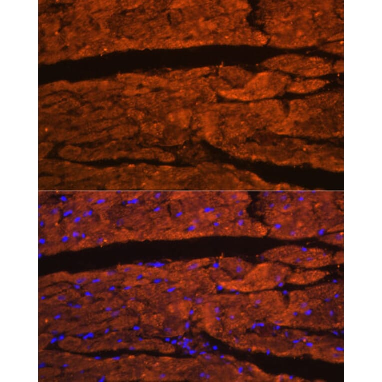 Immunofluorescence - Anti-OBSCN Antibody (A305775) - Antibodies.com