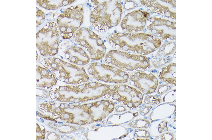 Immunohistochemistry - Anti-BCAR1 Antibody (A305776) - Antibodies.com