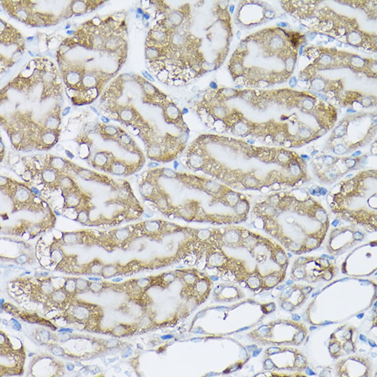 Immunohistochemistry - Anti-BCAR1 Antibody (A305776) - Antibodies.com