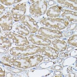 Immunohistochemistry - Anti-BCAR1 Antibody (A305776) - Antibodies.com