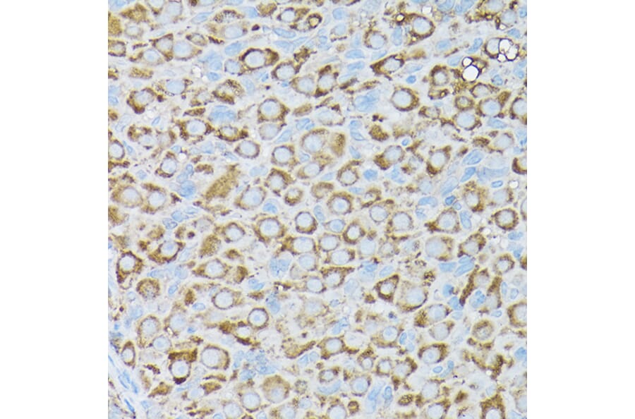 Immunohistochemistry - Anti-BCAR1 Antibody (A305776) - Antibodies.com