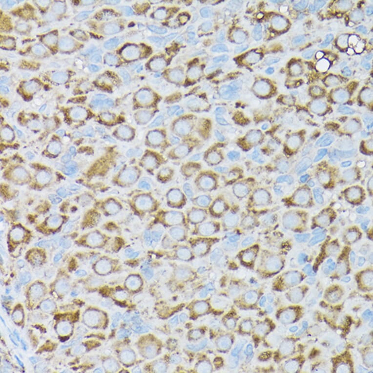 Immunohistochemistry - Anti-BCAR1 Antibody (A305776) - Antibodies.com