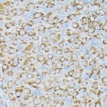 Immunohistochemistry - Anti-BCAR1 Antibody (A305776) - Antibodies.com