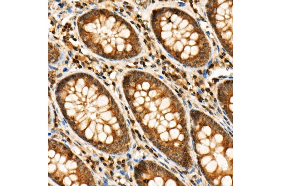 Immunohistochemistry - Anti-RIP3 (phospho Ser227) Antibody (A305777) - Antibodies.com