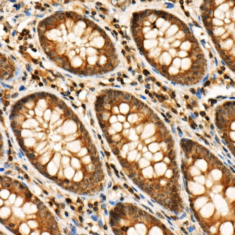 Immunohistochemistry - Anti-RIP3 (phospho Ser227) Antibody (A305777) - Antibodies.com