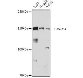 Western Blot - Anti-Timeless Antibody [ARC1827] (A305781) - Antibodies.com