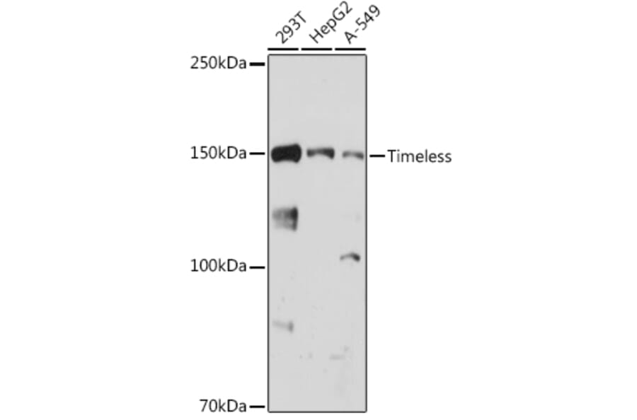 Western Blot - Anti-Timeless Antibody [ARC1827] (A305781) - Antibodies.com