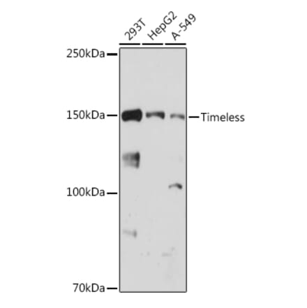 Western Blot - Anti-Timeless Antibody [ARC1827] (A305781) - Antibodies.com