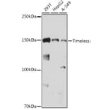 Western Blot - Anti-Timeless Antibody [ARC1827] (A305781) - Antibodies.com