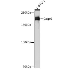 Western Blot - Anti-Caspr Antibody (A305782) - Antibodies.com