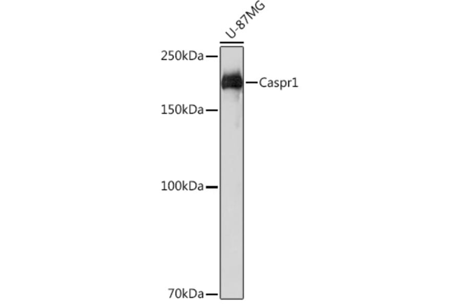 Western Blot - Anti-Caspr Antibody [ARC2084] (A305782) - Antibodies.com